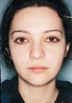 Ünlülerin şok eden değişimi 18