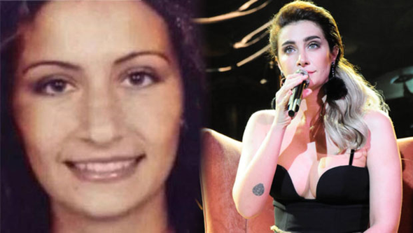 Ünlülerin şok eden değişimi 5