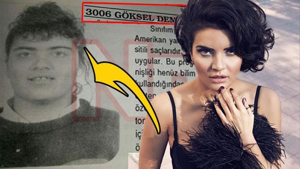 Ünlülerin şok eden değişimi 7
