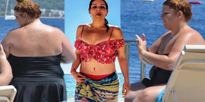 Mide küçültme ameliyatı ile tam 90 kilo verdi! İşte değişimi