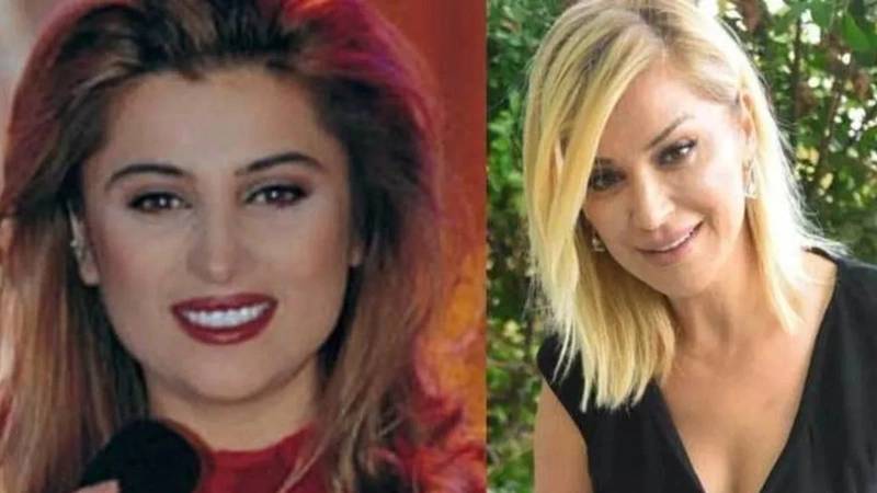 Kerimcan, Melis Sezen, Nesrin Cevadzade... Ünlüleri hiç böyle görmediniz! Estetikten önce, estetikten sonra... 13