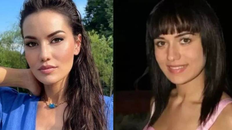 Kerimcan, Melis Sezen, Nesrin Cevadzade... Ünlüleri hiç böyle görmediniz! Estetikten önce, estetikten sonra... 17