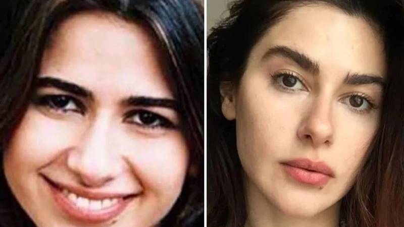 Kerimcan, Melis Sezen, Nesrin Cevadzade... Ünlüleri hiç böyle görmediniz! Estetikten önce, estetikten sonra... 4