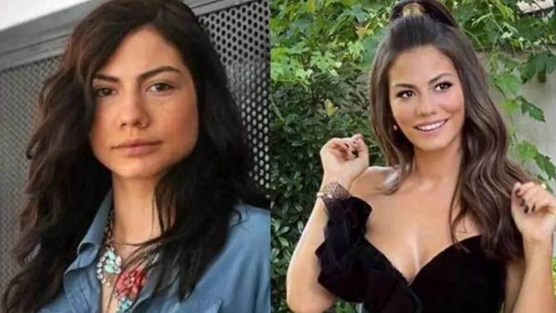 Kerimcan, Melis Sezen, Nesrin Cevadzade... Ünlüleri hiç böyle görmediniz! Estetikten önce, estetikten sonra... 5