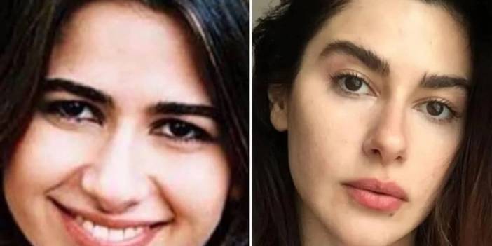 Kerimcan, Melis Sezen, Nesrin Cevadzade... Ünlüleri hiç böyle görmediniz! Estetikten önce, estetikten sonra...