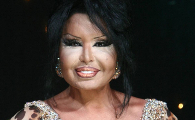 Bülent Ersoy zatürre teşhisiyle hastaneye kaldırıldı