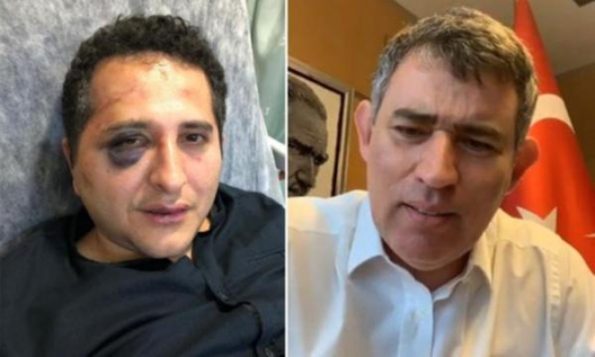 TBB Başkanı Feyzioğlu: Allah belanızı versin, şakağıma tabanca dayasanız bu işin peşini bırakmam