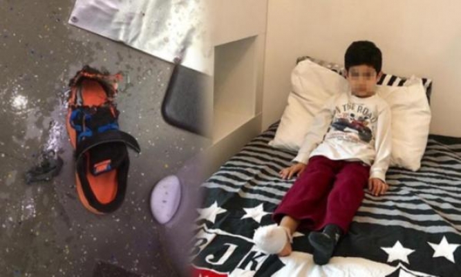 AVM'de ayağı yürüyen merdivene sıkışan çocuğun 2 parmağı koptu: Yetkililer ayakkabıyı suçladı