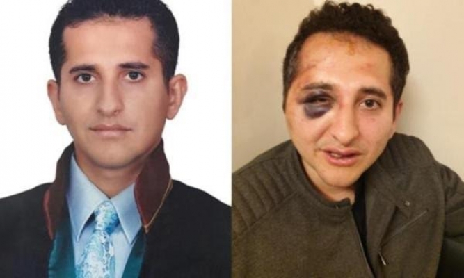 YURT ÖZEL | Darp edilen avukattan mesaj var