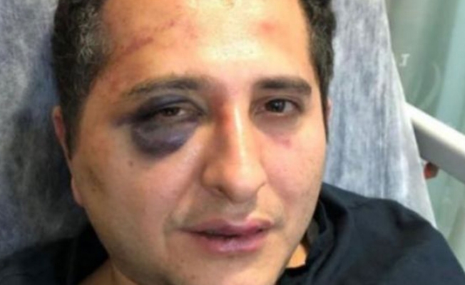 Bilirkişi raporu açıklandı: Cumhurbaşkanı'na hakaret yok