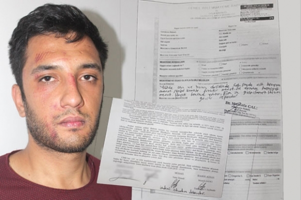 İş isteyen gence belediye personelinden dayak