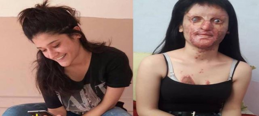 Berfin'in yüzüne asit atan saldırgan için istenen ceza belli oldu