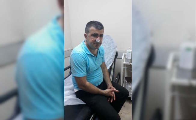 ÖZEL | Alevi derneği yöneticisine saldırı