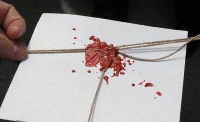 Diyarbakır Büyükşehir Belediyesi'nin tesisleri kaymakamlık tarafından mühürlendi
