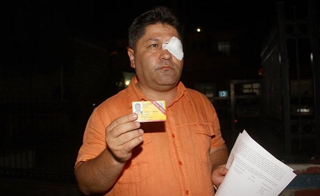 Bir gazeteciye daha saldırı