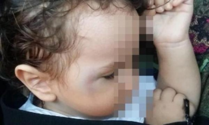 Vahşet: Bebeği yumrukladılar