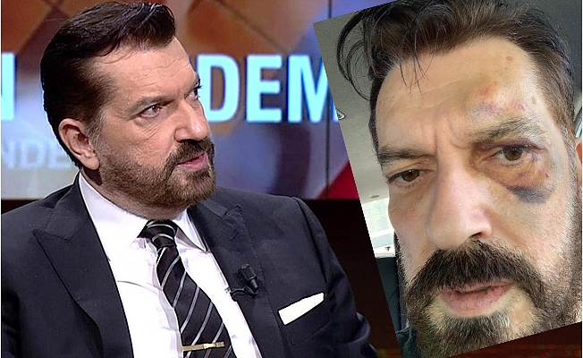 Ünlü anketçiye İstanbul'un ortasında saldırı: Ülkücüler de olabilir, PKK da...