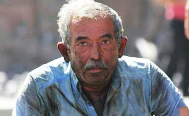 Kendini yakan yurttaş gerçek yangını hastanede yaşadı: Yer yok!