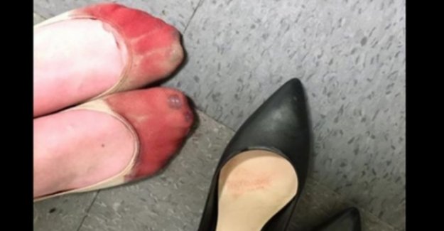 Topuklu giymeye zorlanan garson, kanayan ayaklarının fotoğrafını paylaştı