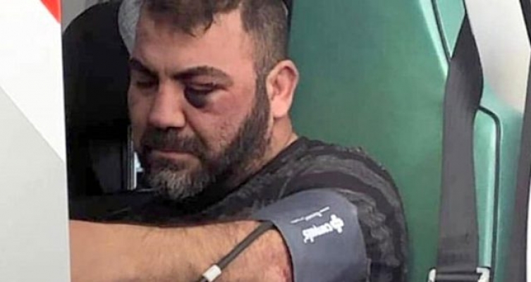 Alman polisi, Türk vatandaşını darp etti