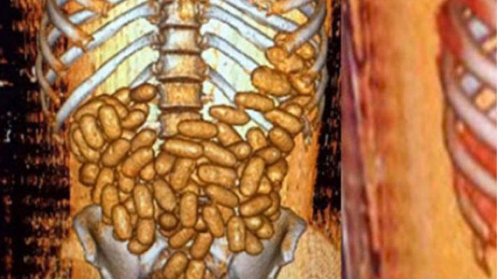 Midesinde 1.2 kilogram uyuşturucuyla yakalandı