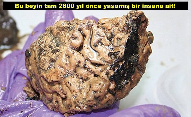 2600 yıllık insan beyni bulundu