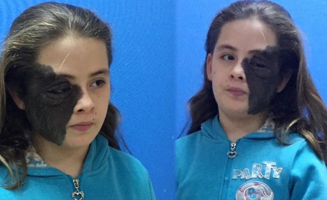 Üniversitesinden müjdeli haber: Nazlı tedavi olacak