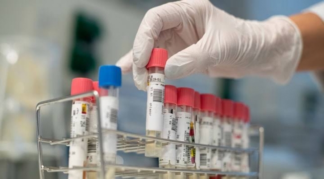 İzmir’deki üç sağlıkçının koronavirüs test sonucu sevindirici