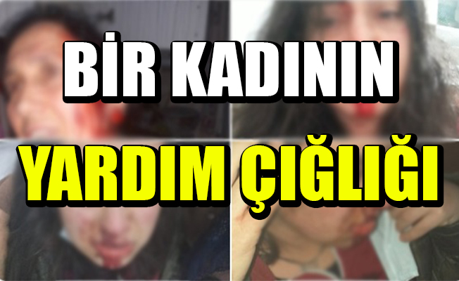 Bir kadının yardım çığlığı; Sesimizi ölmeden duyun