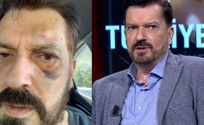 Hakan Bayrakçı uğradığı saldırıyı anlattı