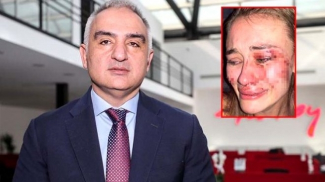 Bakan Ersoy'dan Çeşme'deki darp olayıyla ilgili açıklama
