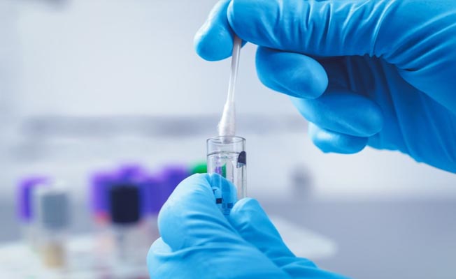 Son 24 saat içerisinde 113 bin 102 yeni test yapıldı