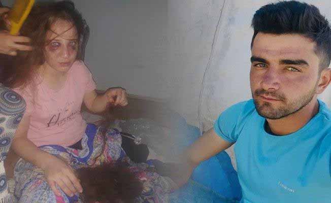 Eşine defalarca işkence yaptı serbest kaldı