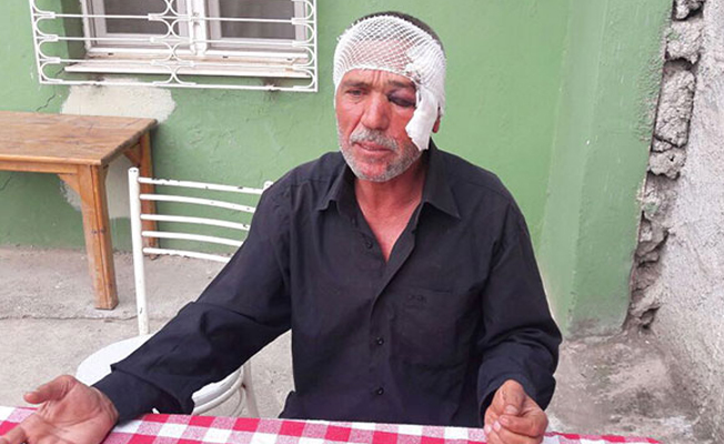 'Evet broşürü almayınca saldırdılar'