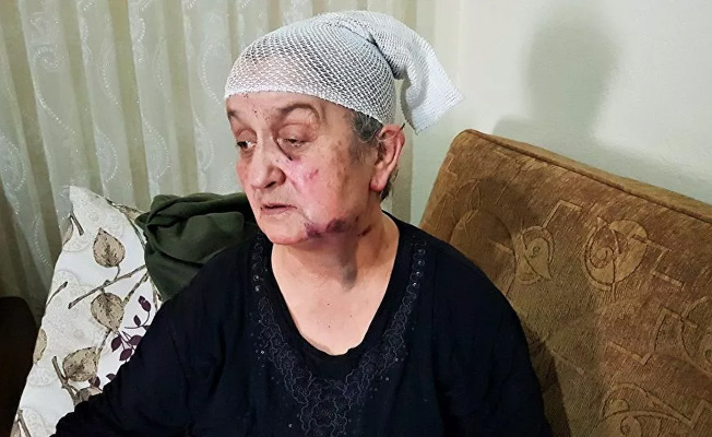 Hırsızdan ölü taklidi yaparak kurtuldu