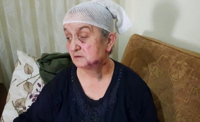 Ölü taklidi sayesinde yaşadı