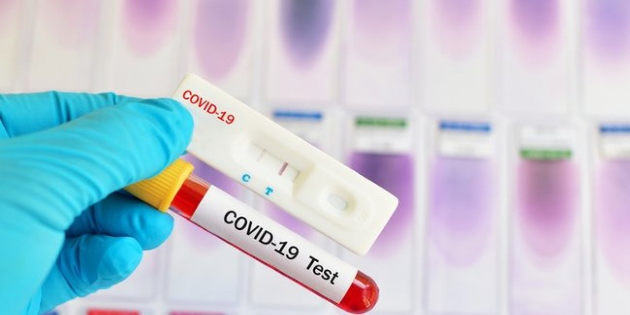 Ankara'da şok görüntüler! PCR testleri yol kenarında bulundu