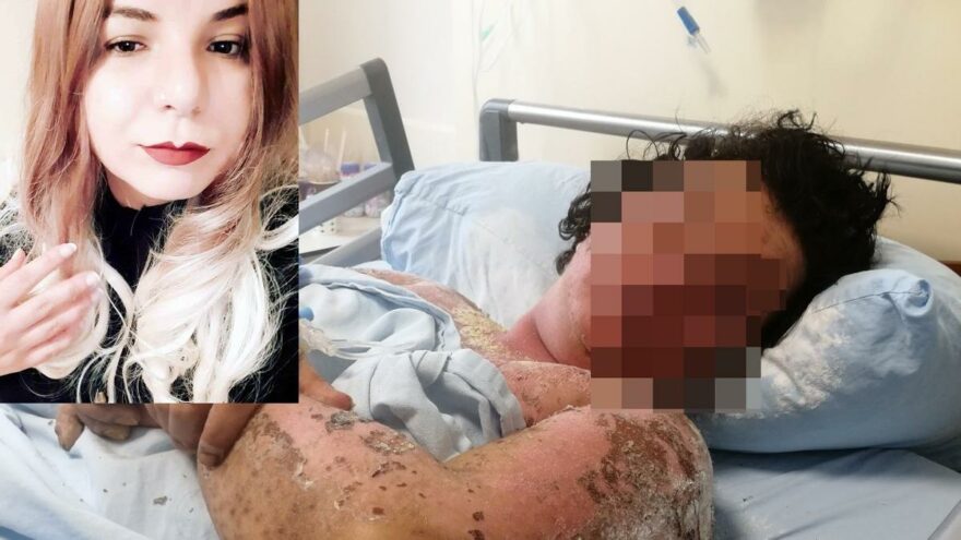Yanlış antibiyotik kullanımı hayatını mahvetti