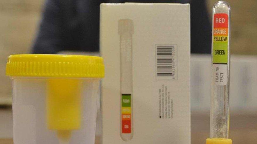 Türk doktor koronavirüs tespiti için idrar kiti geliştirdi