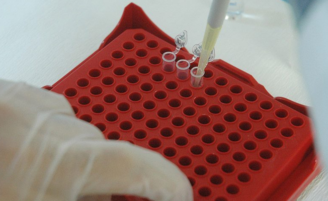 Türk bilim insanları ‘kanser tanı kiti’ oluşturdu