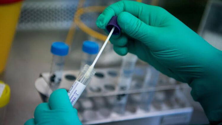 Koronavirüs testinin önce pozitif sonra negatif çıkması kafaları karıştırdı