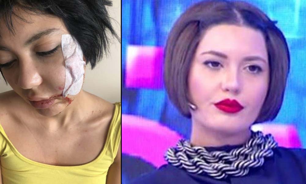 Bahar Candan darp edildi: Yüzünde 10 dikiş var!