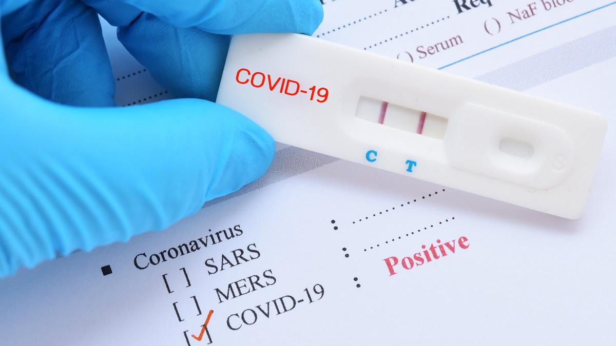 Negatif çıkan koronavirüs testlerine ilişkin flaş uyarı