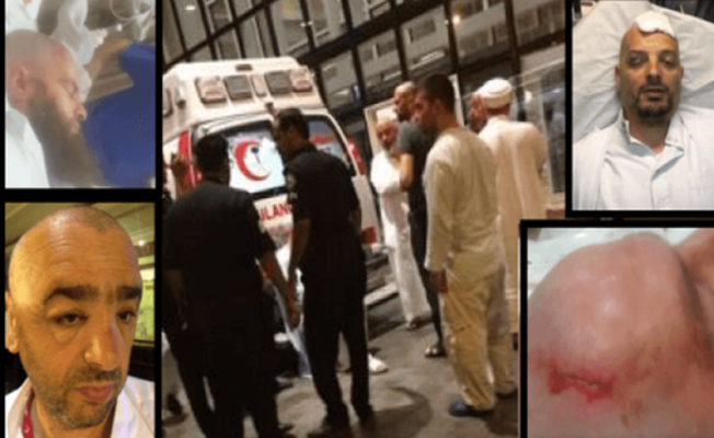 Mekke kavga eden Türk cemaatlerin ateşi düşmüyor