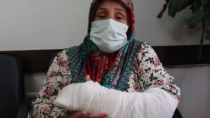 'İşkence tespiti yok' diyen Süleyman Soylu'ya, polisler tarafından darp edilen Kevser Demir sorusu