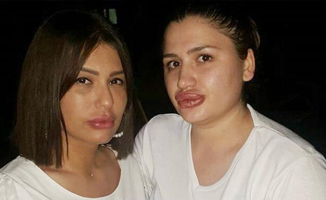 Sağlık Bakanlığı'ndan 'silikon' skandalına ilişkin açıklama 