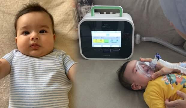 Son 24 günü kalan Eyüp Çınar bebek 10 TL bağışlayacak 15.000 kişi arıyor!
