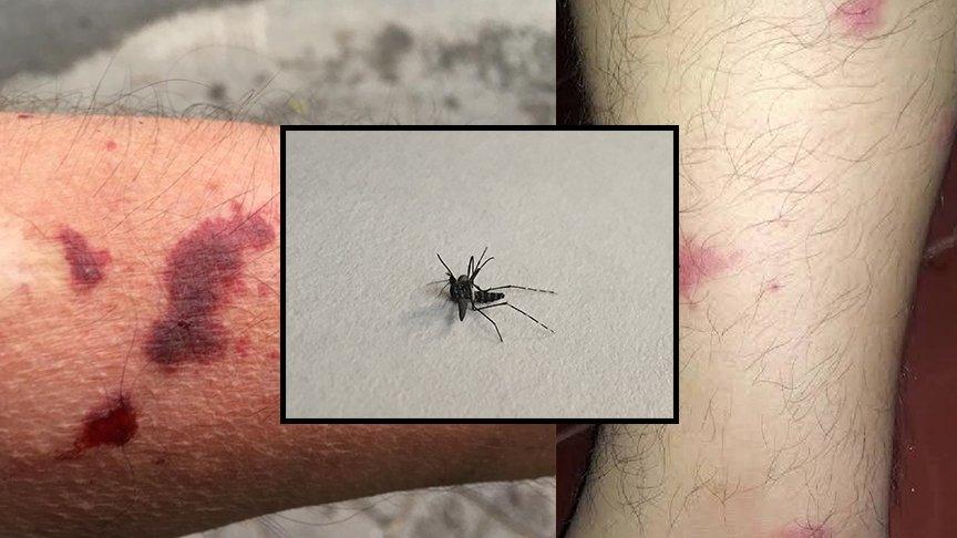 Dikkat! O şehirler Asya Kaplan Sivrisineği tehlikesiyle karşı karşıya...