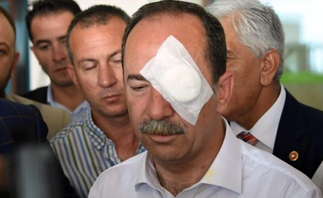CHP'li Başkan 'hodri meydan' dedi