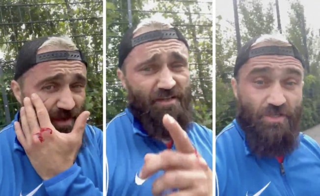 Muhalif boksör Ünsal Arık'a şok saldırı
